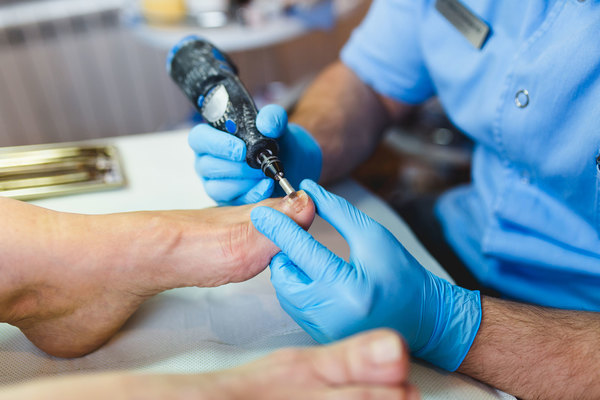 Fungal Nail Treatment
